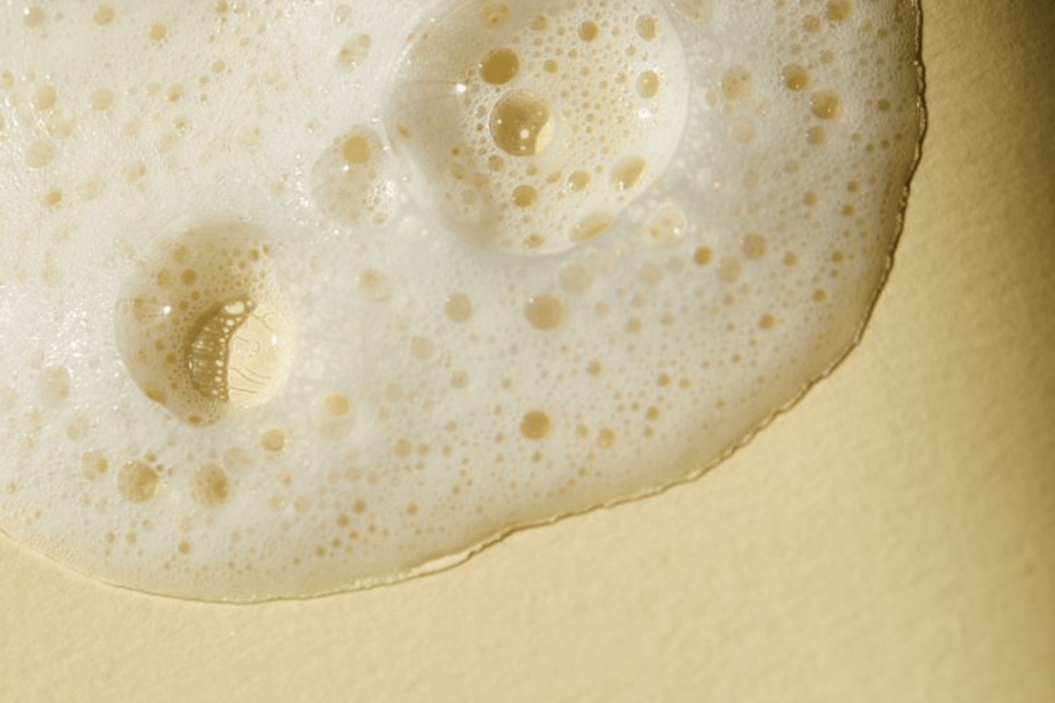 large pores, you say?