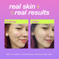 breakout clearing booster real skin real results