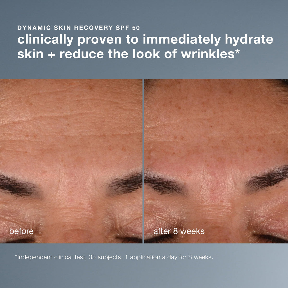 dynamic skin recovery spf50 clinical 