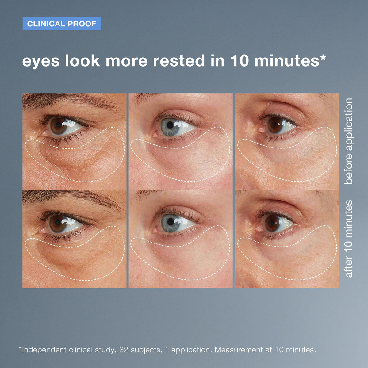 awaken peptide depuffing eye gel before and after 