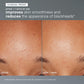 daily microfoliant exfoliator clinical