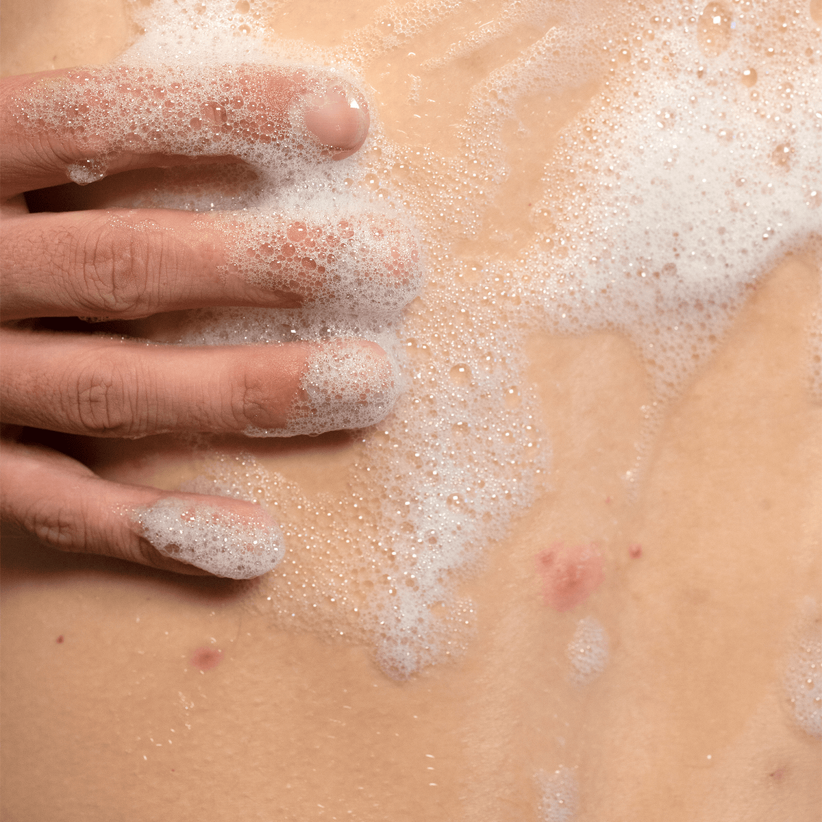 back treatment 