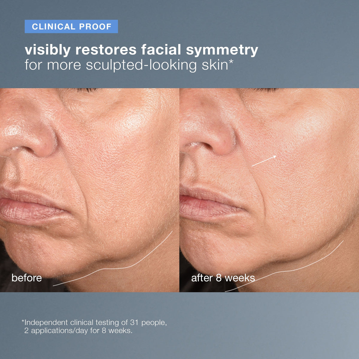 neurotouch symmetry serum clinical proof 