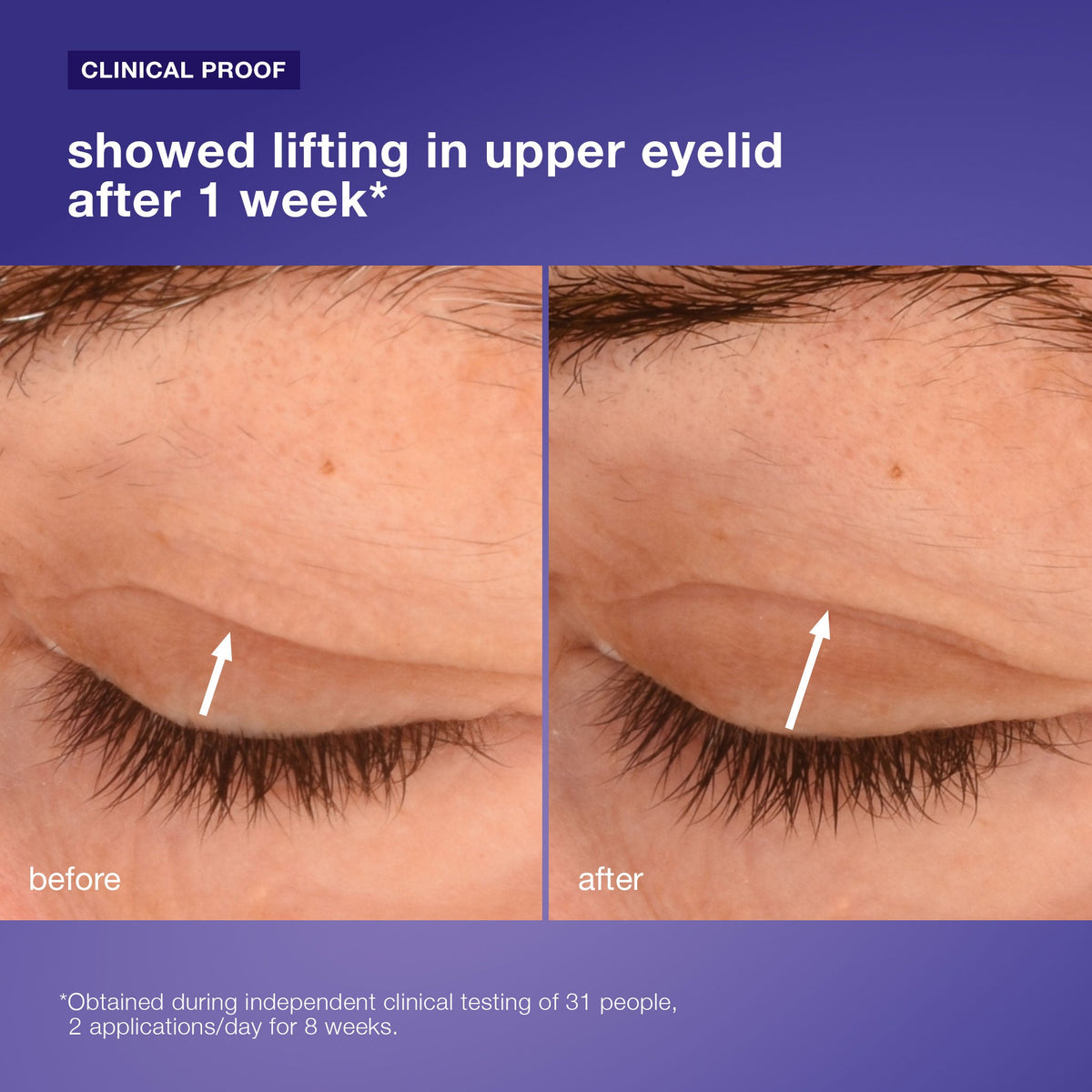 phyto nature lifting eye cream clinical 