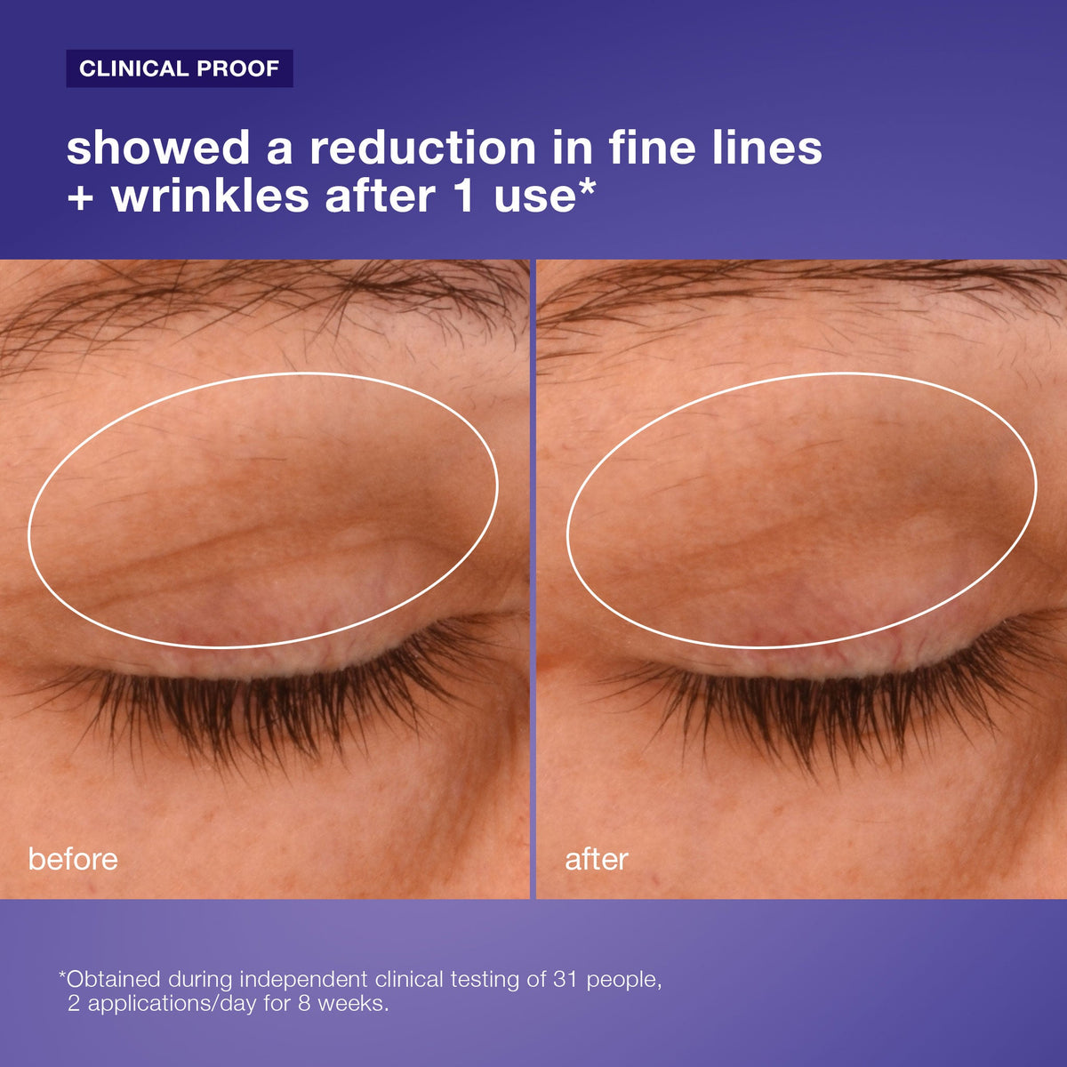 phyto nature lifting eye cream clinical 