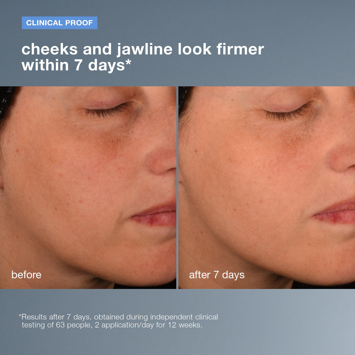 pro-collagen banking serum clinical 