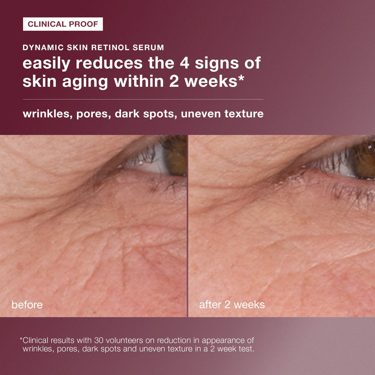 skin aging solutions kit clinical proof 