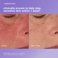 stabilizing repair cream clinical