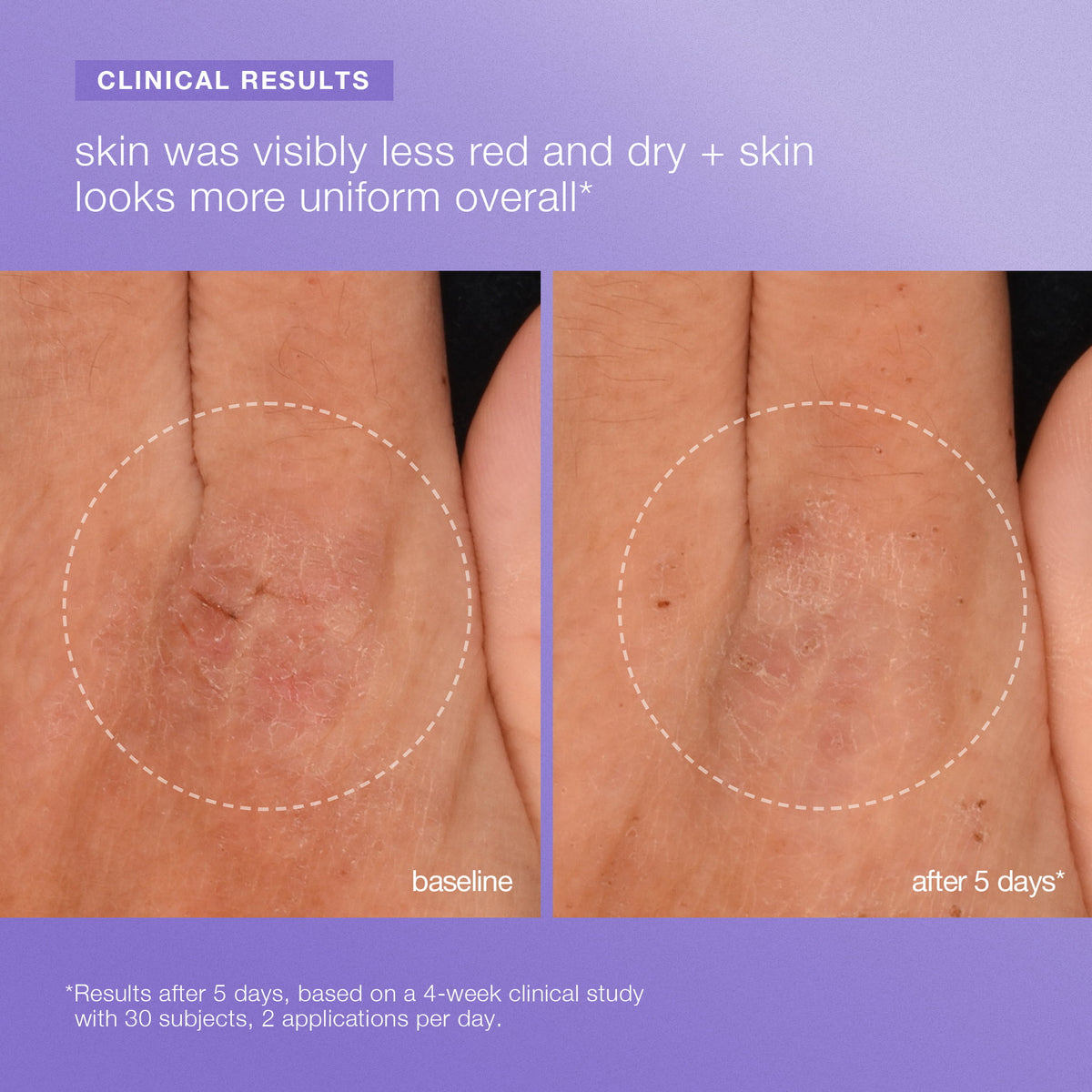 stabilizing repair face + body serum clinical 